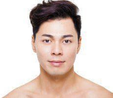 Laser Hair Removal for Men Los Angeles Treatment Experts